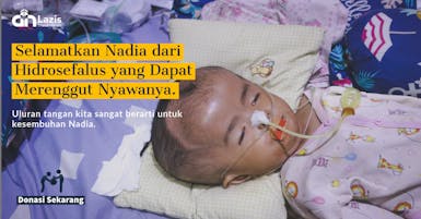 Hidrosefalus Sejak Lahir, Kepala Nadia Semakin Membesar