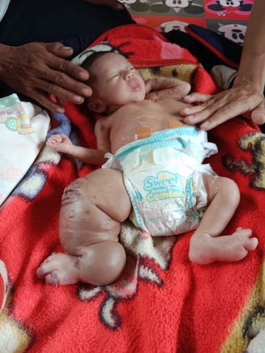 Urgent bantu putra buruh serabutan kuli bangunan dan istri kuli serabutan harian lepas cuci baju,beliau putranya Muhammad Rizal perlu biaya untuk operasi dan pengobatan