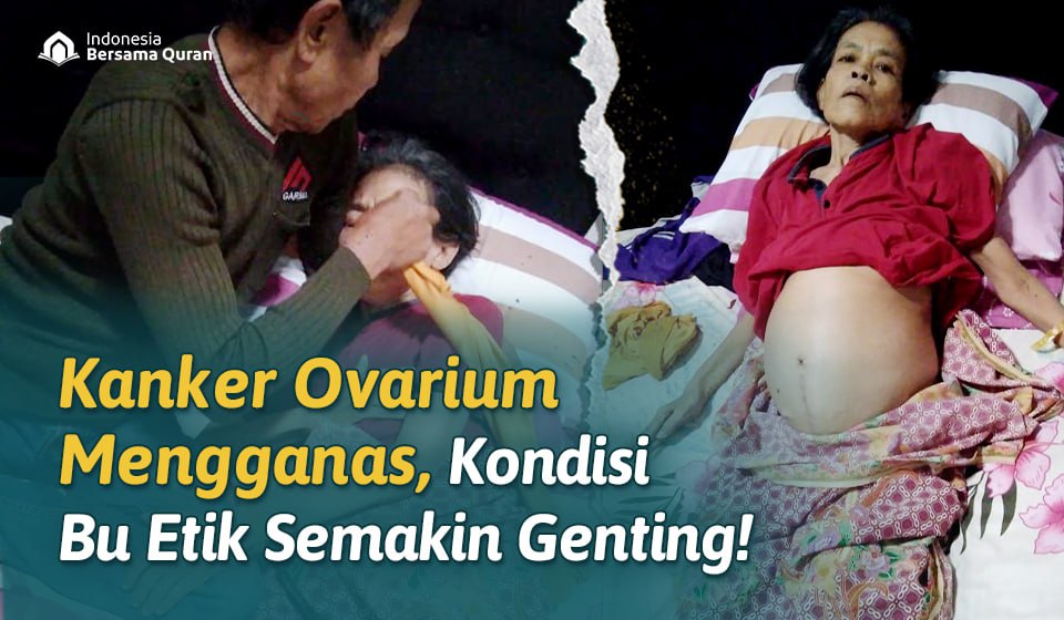 Gawat! Kanker Ovarium Mengganas, Bu Etik Butuh Pengobatan Segera