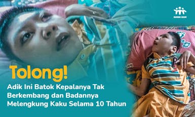 Batok Kepala Tak Berkembang, Bantu Fahri Berobat dan Terapi