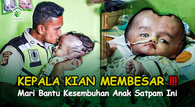 Kepala Kian Membesar, Mari Bantu Kesembuhan Anak Satpam Ini