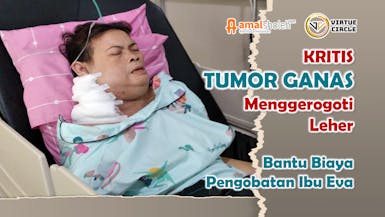 TUMOR GANAS gerogoti leher Ibu Eva