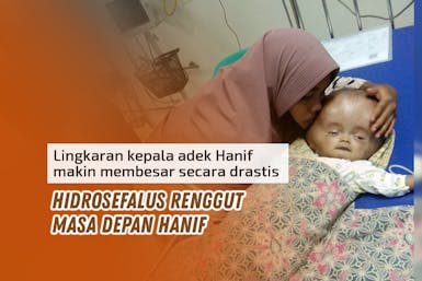 Lingkar Kepala Makin Membesar, Ayo Bantu Adik Hanif Sembuh dari Hidrosefalus