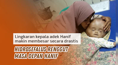 Lingkar Kepala Makin Membesar, Ayo Bantu Adik Hanif Sembuh dari Hidrosefalus