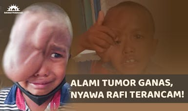 Bantu Rafi Ahmad Sembuh dari Tumor