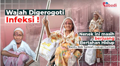 Miris! Infeksi Parah, Sebelah Matanya Hampir Membusuk