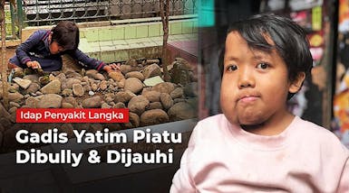 TOLONG! Alena, Anak Yatim Piatu Penderita Tumor Ganas Langka Ingin Sembuh.