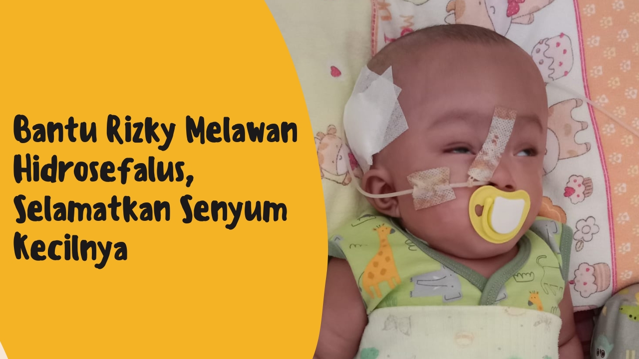 Kepala Rizky Terus Membengkak,Hidrosefalus Bisa Merenggut Nyawanya
