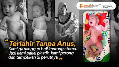 BANTU DIK MIFKA SEMBUH DARI ATRESIA ANI