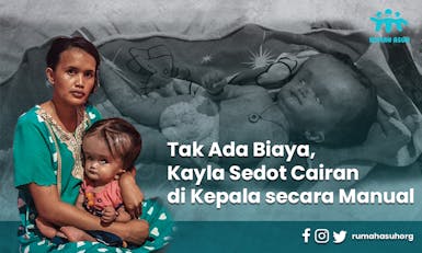 Hidup dengan Selang, Cairan terus Penuhi Kepala Kayla