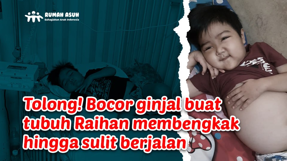 6 Tahun Melawan Bocor Ginjal, Bantu Raihan Sembuh