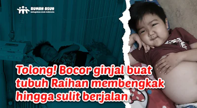 6 Tahun Melawan Bocor Ginjal, Bantu Raihan Sembuh