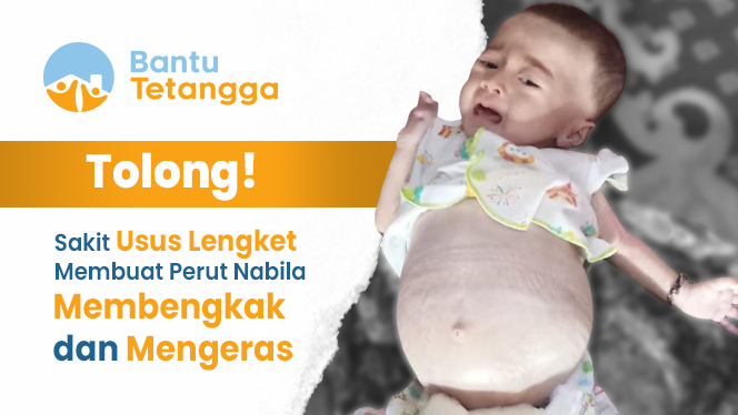 Perutnya Terus Membesar, Nabila Ingin Sembuh