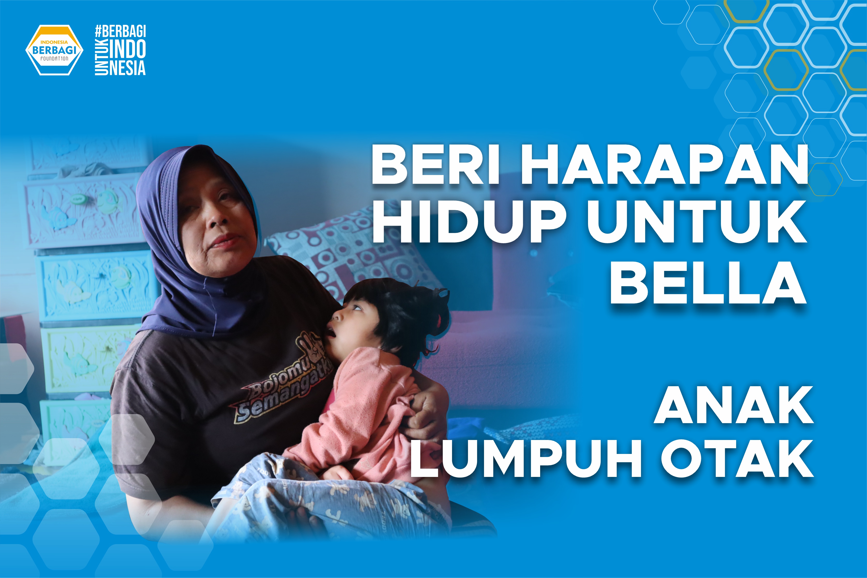 Beri Harapan Hidup untuk Bella, Anak Lumpuh Otak