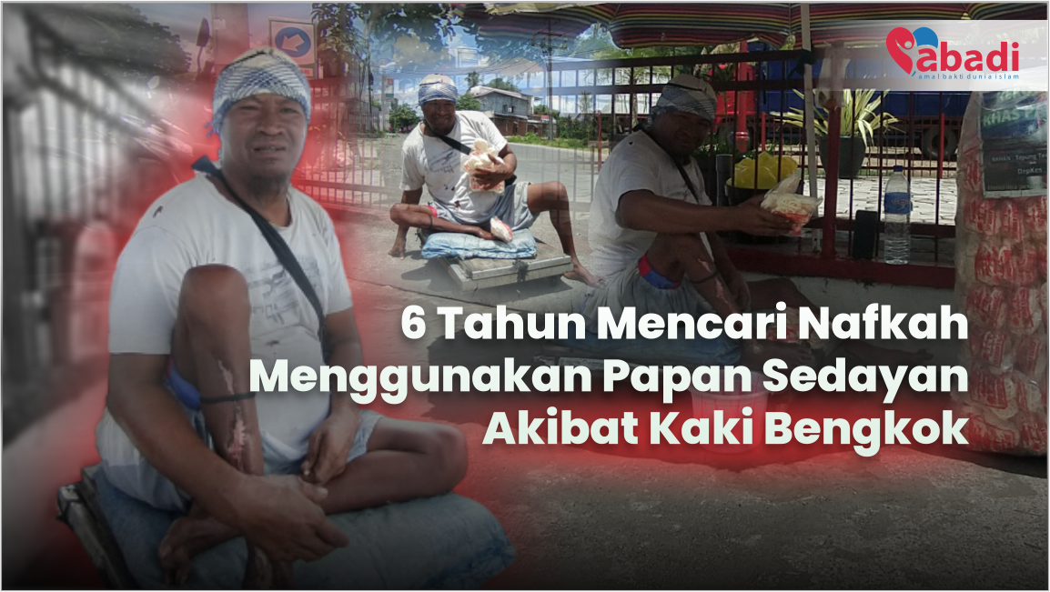 6 Tahun Nafkahi Keluarga menggunakan Papan Sedayan Akibat Kaki Bengkok
