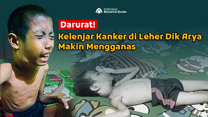 Bantu Dik Arya Sembuh dari Kanker Pembuluh Darah