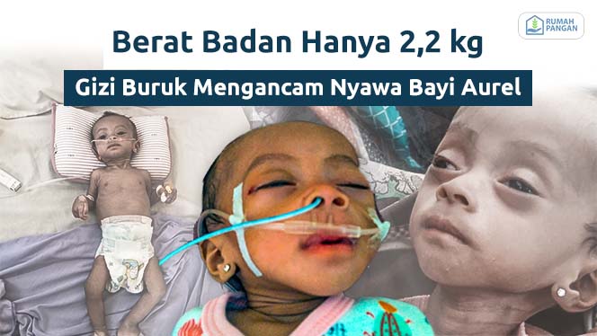 Berat Badan Hanya 2,2 kg, Bayi Aurel Bertaruh Nyawa Melawan Gizi Buruk