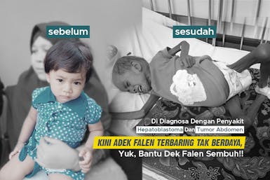 Keceriaan Adek Falen Direnggut Tumor, Bantu Ia Kembali Sehat