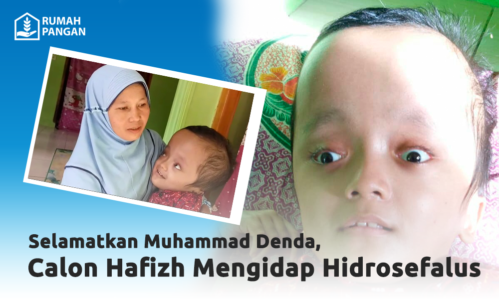 Selamatkan Muhammad (Calon Hafizh) dari Hidrosefalus..