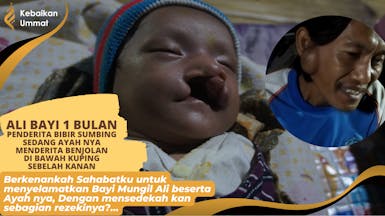ALI, BAYI SATU BULAN PENGIDAP BIBIR SUMBING PARAH DAN AYAH NYA MENDERITA BENJOLAN DI DEKAT KUPING.