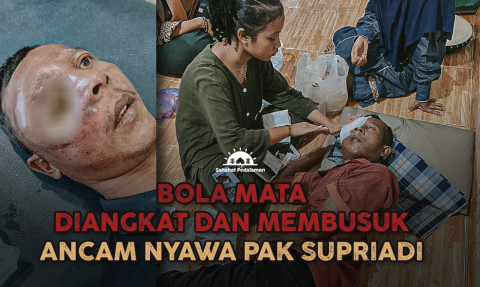 Alami Kanker, Pak Supriadi Tidak Punya Satu Bola Mata!