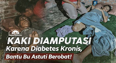Kaki Diamputasi Karena Diabetes Kronis, Bantu Bu Astuti Berobat!