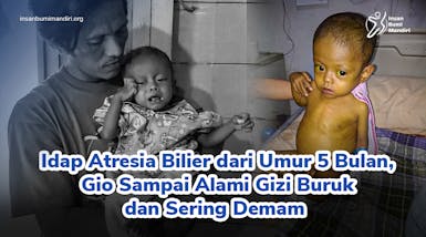 Atresia Bilier, Penyakit Langka yang Renggut Kebahagiaan Gio