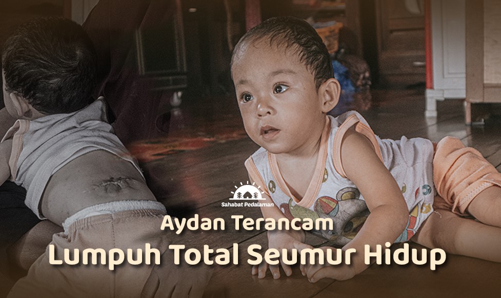 Bantu Pengobatan Aydan yang Alami Spina Bifida