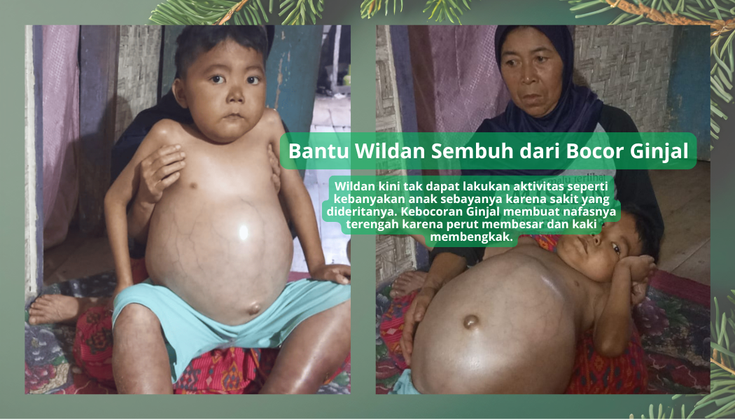 Setiap Detak Jantung Wildan Adalah Harapan Mari Selamatkan Bocah 7 Tahun dari Bocor Ginjal