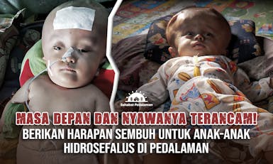 Ulurkan Tangan untuk Keselamatan Nyawa Anak-Anak Pengidap Hidrosefalus