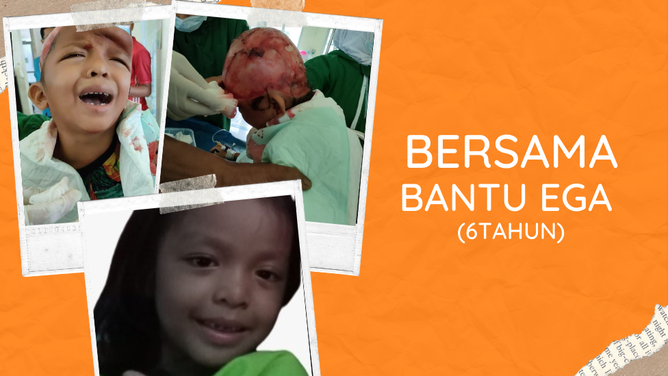 Kecelakaan Tragis! Rambut Terlilit as Mesin Pompong Kepala Bocah 6 tahun Mengelupas