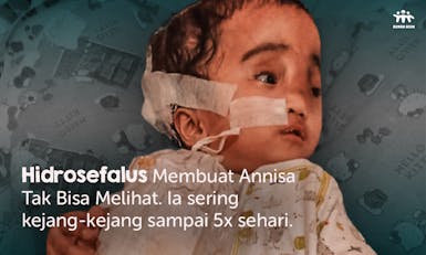 Gawat! Hidrosefalus Menyumbat Napas Nisa hingga Tak Bisa Melihat