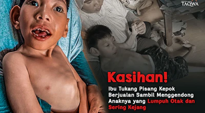 Bantu Dik Zaky Dapatkan Terapi Lumpuh Otak