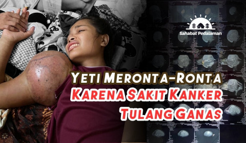 Yeti Meronta-Ronta Karena Sakit Kanker Tulang Ganas