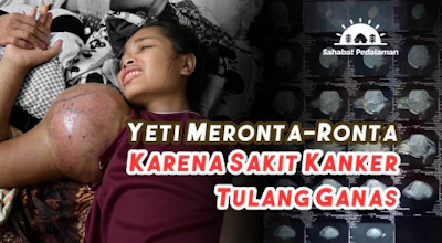 Yeti Meronta-Ronta Karena Sakit Kanker Tulang Ganas