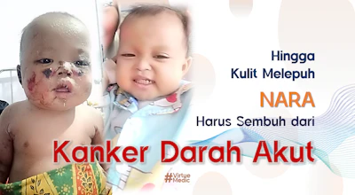 Kulit Melepuh..!!! Nara tetap harus jalani Kemoterapi Kanker Darah