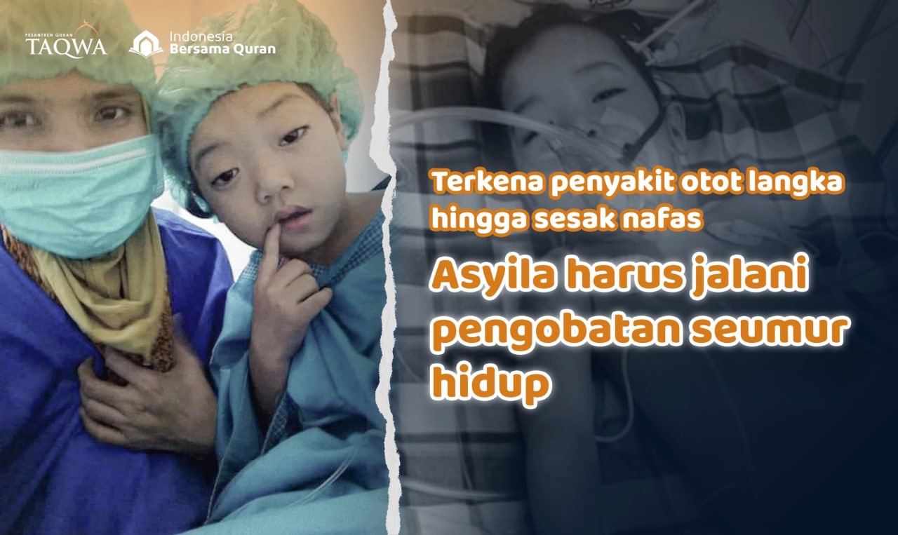 Temani Asyila dan Ibunya Berjuang Melawan Penyakit Langka