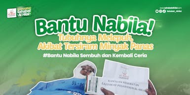 Bantu Nabila Sembuh Tubuhnya Melepuh Tersiram Minyak Panas