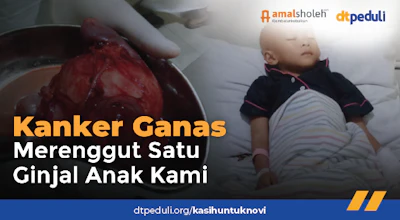 Kanker Ganas Merenggut Satu Ginjal Anak Kami