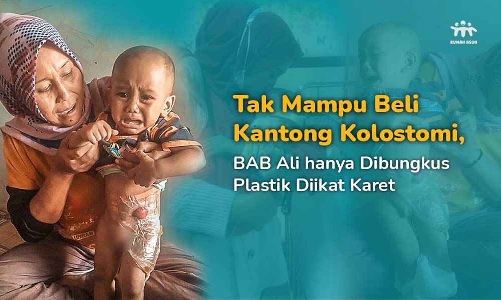 Tak Miliki Anus, Ali hanya Bisa BAB di Plastik Lewat Perutnya