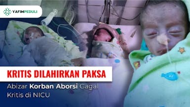 ‘Gagal’ Digugurkan, Abizar Berjuang Hidup di NICU