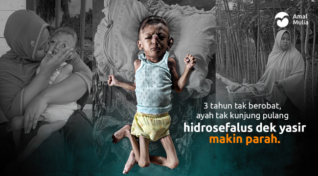 Hidrosefalus Dek Yasir Semakin Kritis, Bantu Bawa Yasir Berobat ke RS