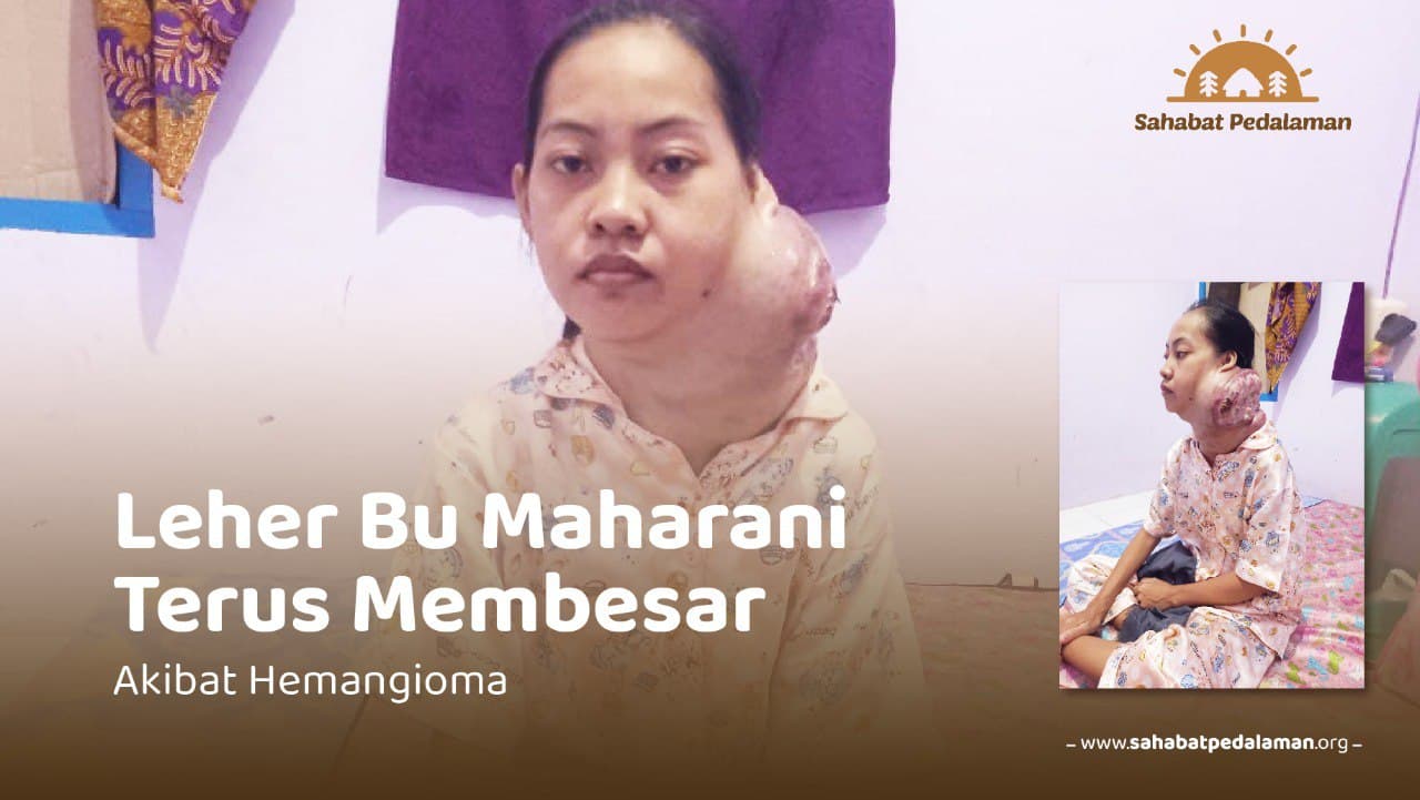 Benjolan di Leher Ancam Nyawa Bu Maharani