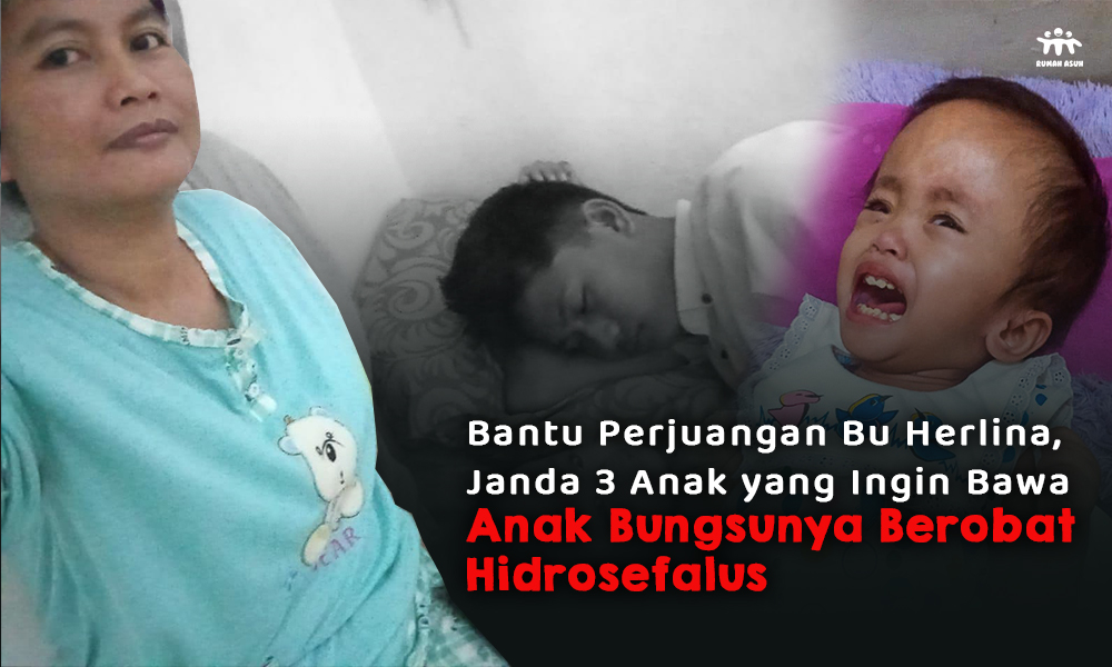 Bantu Bu Herlina Bawa Anaknya Berobat Hidrosefalus