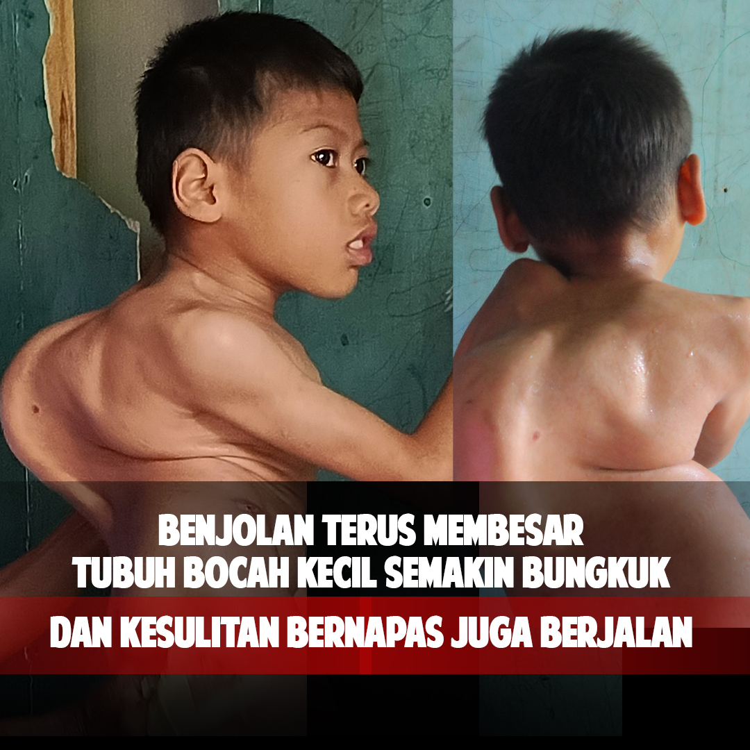 Tubuh Bungkuk Bocah Kecil Berjualan Agar Tetap Sekolah