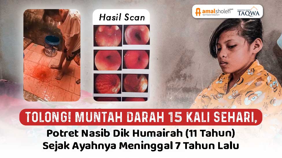 Segera Bantu Dik Humairah Sembuh Dari Penderitaannya