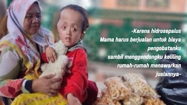 ANAK PENJUAL MAKARONI JALANAN, TAK MAMPU OPERASI CINDY IDAP HIDROSEPALUS