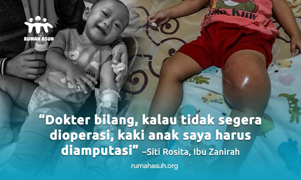 Jinsiy fotosuratda noziklik