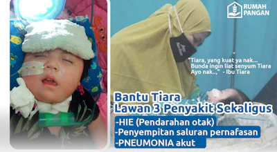 Pilu.. Demi Bisa Terus Bernapas, Tiara Butuh Rp 6 Juta per Bulan