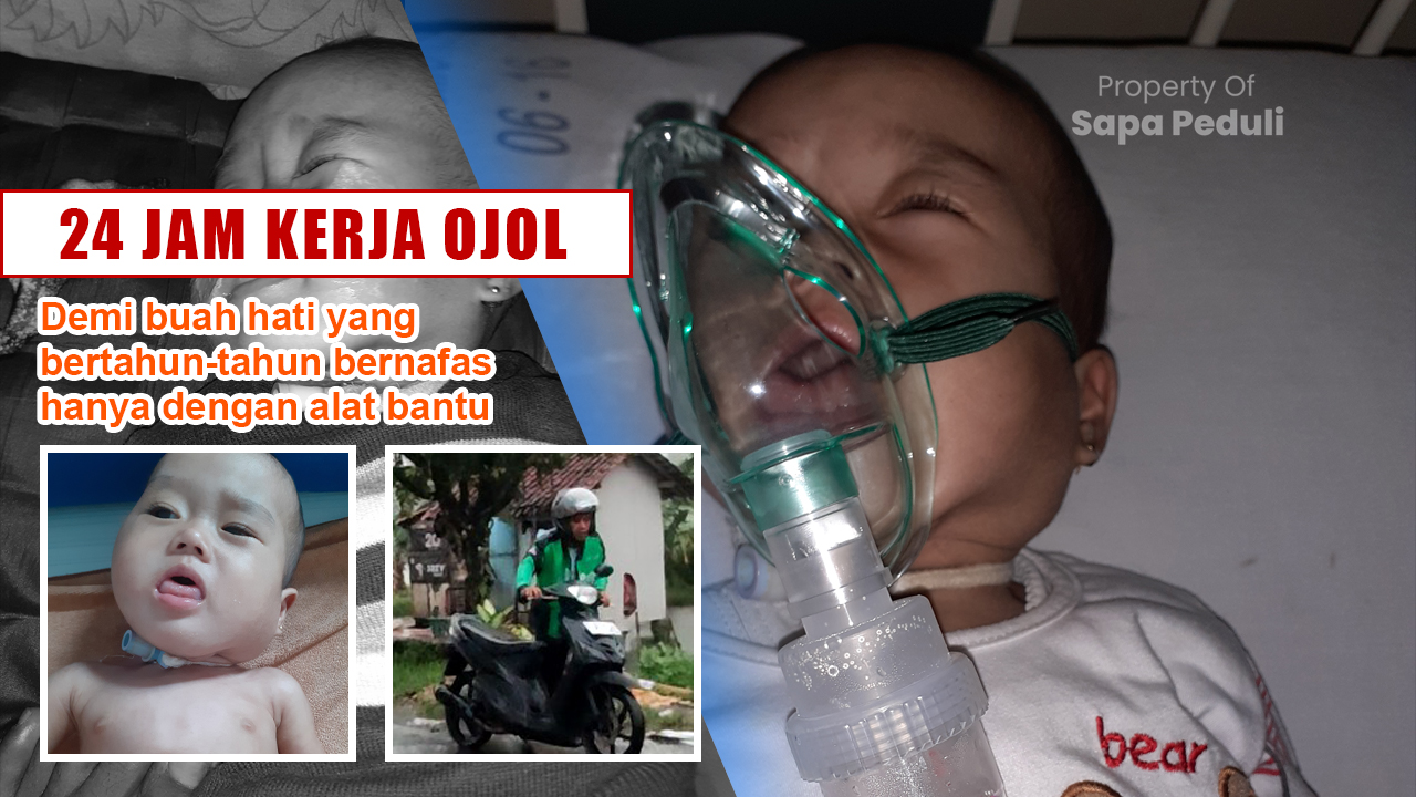 24 JAM KERJA! Ojol ingin anaknya lepas alat Nafas sembuh dari sakit higroma colli